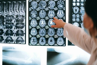 NeuroLink AI: Next-Generation Brain-Computer Interfaces featured image